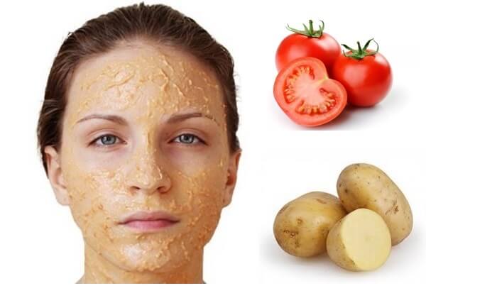 Chữa nám da mặt bằng cà chua và khoai tây