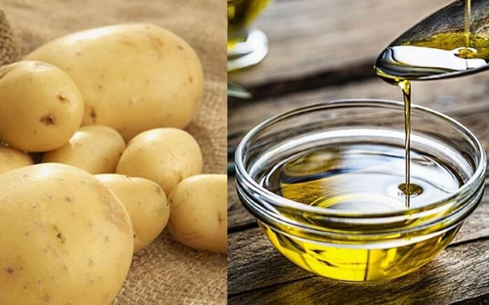 Cách trị nám tàn nhang bằng khoai tây và dầu oliu
