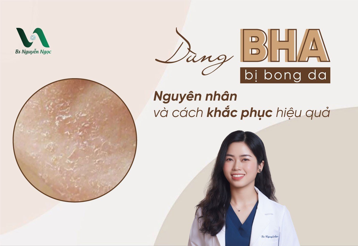 Dùng BHA bị bong da: Nguyên nhân và cách khắc phục hiệu quả