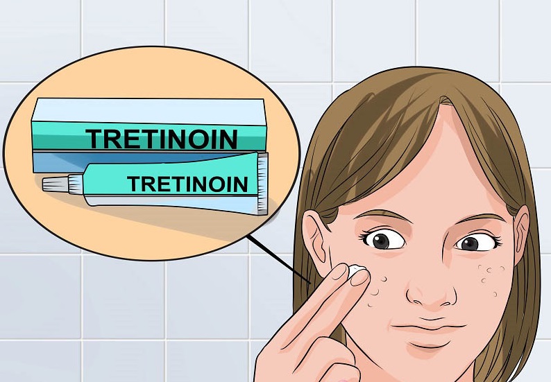 8 Lưu ý khi dùng Tretinoin an toàn hiệu quả