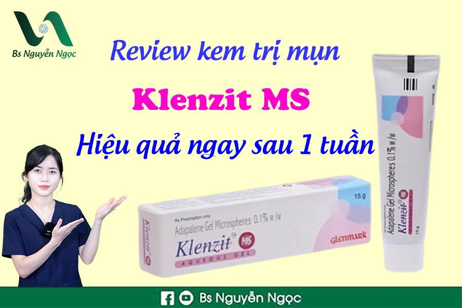 Review kem trị mụn Klenzit MS