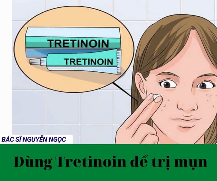 Có nên sử dụng Tretinoin trị mụn?