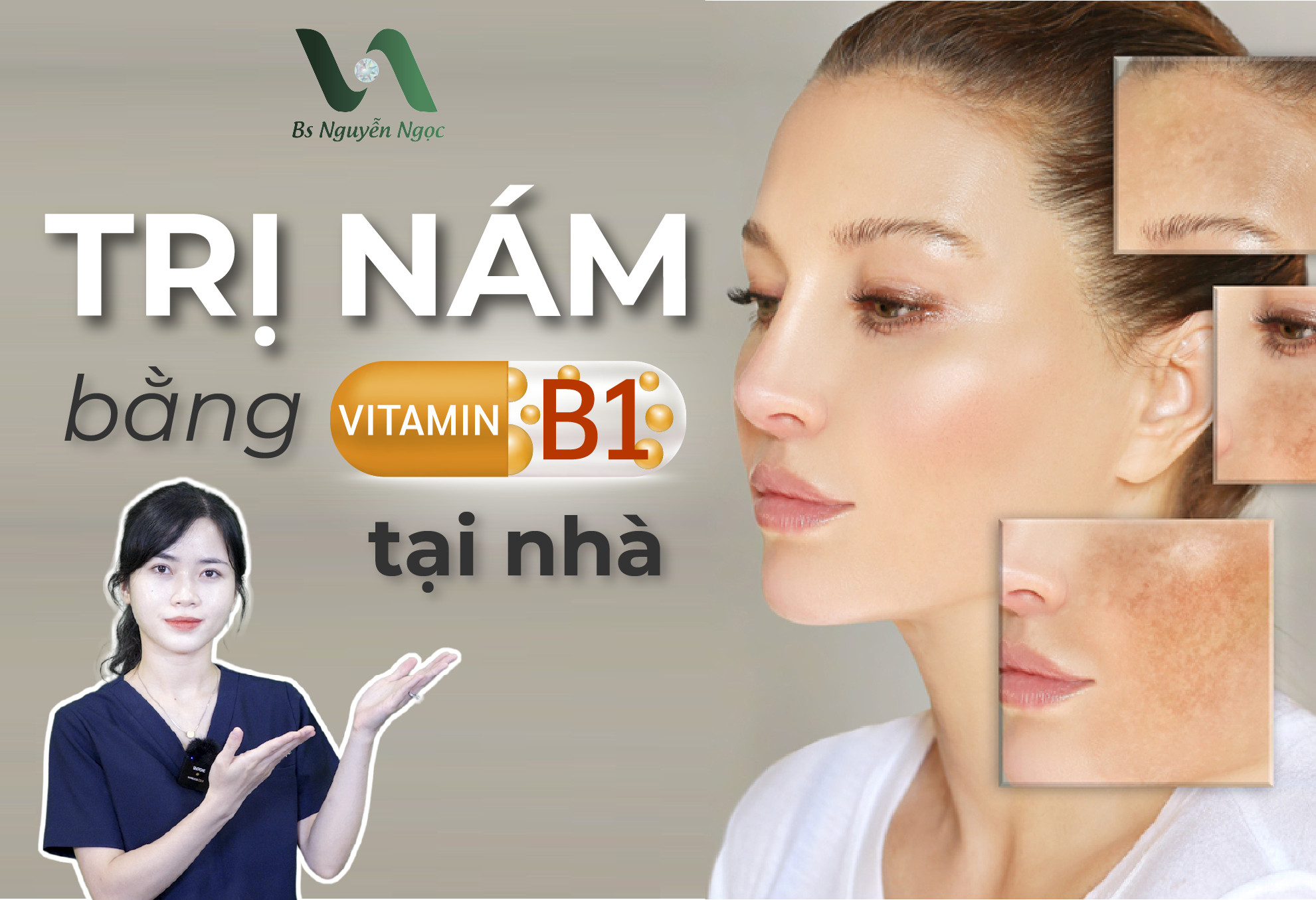Cách trị nám bằng vitamin B1 nhanh chóng ngay tại nhà