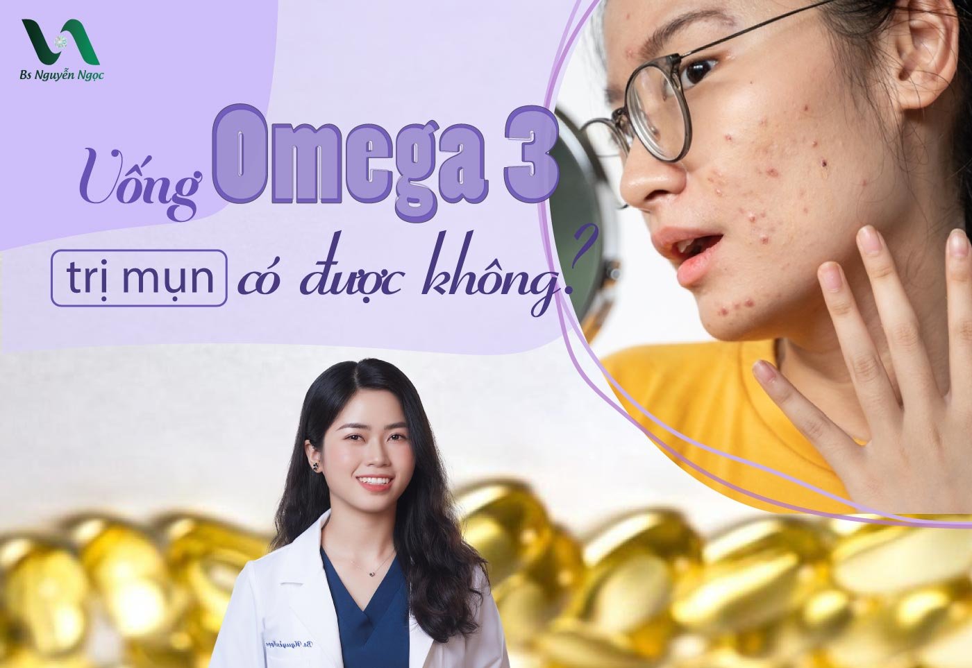 Uống Omega 3 trị mụn có được không?